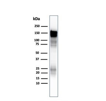 EGF Receptor / EGFR Antibody (cytoplasmic domain)