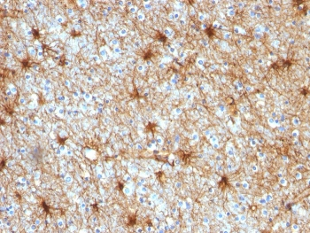GFAP Antibody / Glial Fibrillary Acidic Protein