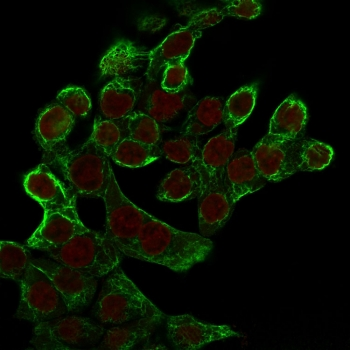 KRT8 Antibody / Cytokeratin 8