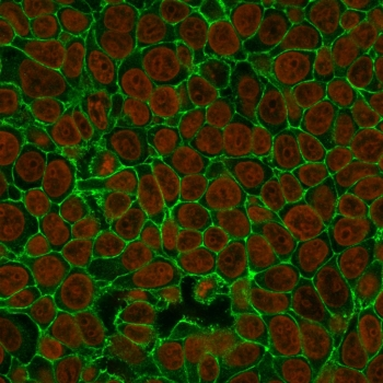 EpCAM Antibody