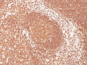 CD45 Antibody (Leukocyte marker)
