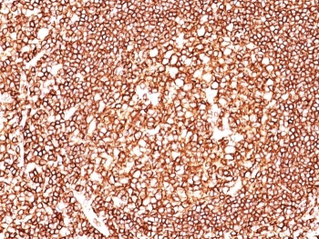 CD45 Antibody (Leukocyte marker)