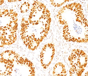p53 Antibody / TP53 (N-Terminal Region)
