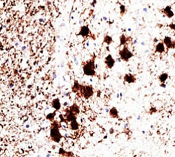 PGP9.5 / UchL1 Antibody