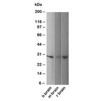 PGP9.5 / UchL1 Antibody