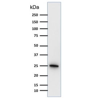 PGP9.5 / UchL1 Antibody