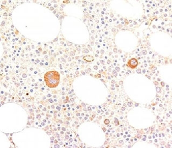 von Willebrand Factor Antibody / vWF