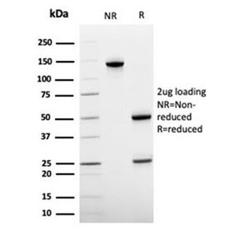 von Willebrand Factor Antibody / vWF