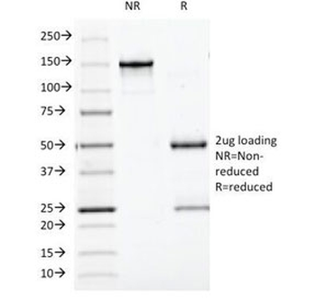 Bcl10 Antibody