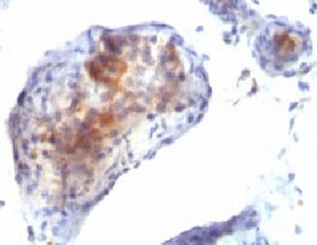 FOXP3 Antibody