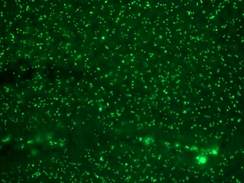 Human Nucleolar Antigen Antibody / Nucleoli Marker
