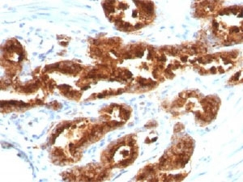 TAG-72 Antibody