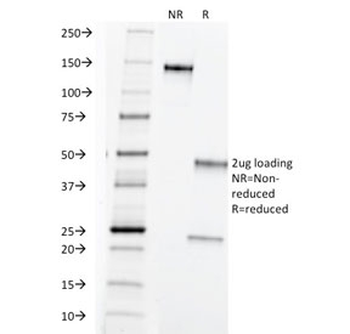 TAG-72 Antibody