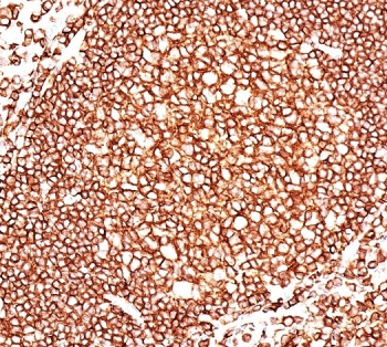 CD45 Antibody (Leukocyte marker)
