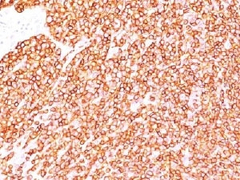 CD45 Antibody