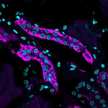 Cadherin 16 Antibody