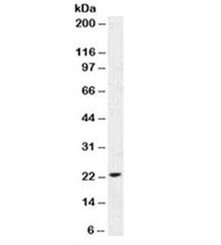 p21 Antibody / CDKN1A