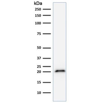 p21 Antibody / CDKN1A