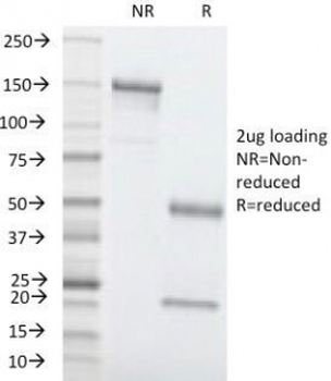 CEA Antibody / Carcinoembryonic Antigen