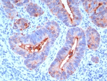 CEA Antibody / CEACAM5