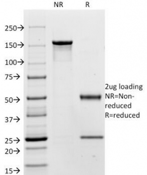 CEA Antibody / CEACAM5