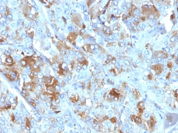 Chromogranin A Antibody