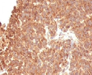 TOP1MT Antibody / Topoisomerase I mitochondrial