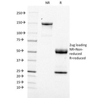 TOP1MT Antibody / Topoisomerase I mitochondrial