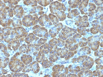TOP1MT Antibody / Topoisomerase I mitochondrial