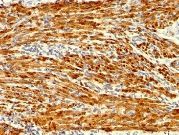 Calponin 1 Antibody
