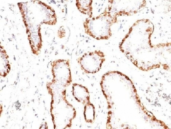 Calponin 1 Antibody
