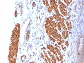 Calponin 1 Antibody