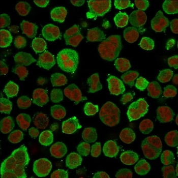 Calponin 1 Antibody
