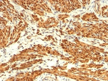 Calponin 1 Antibody Cocktail