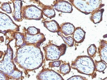 EGF Receptor / EGFR Antibody