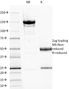 EGF Receptor / EGFR Antibody