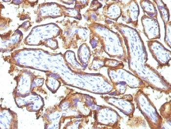 EGF Receptor / EGFR Antibody Cocktail