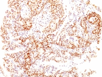 Estrogen Receptor beta Antibody