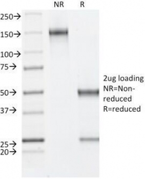 Estrogen Receptor beta Antibody