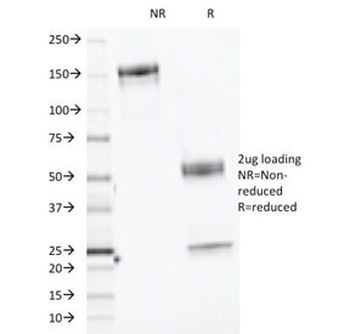CELA3B Antibody / Elastase 3B