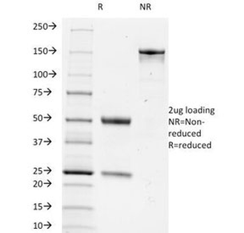 TRIM29 Antibody