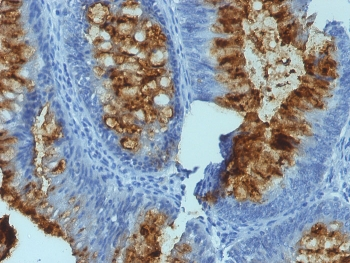 FUT3 Antibody / Blood Group Lewis b