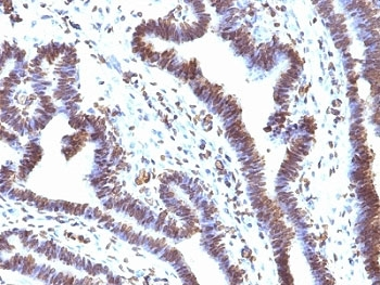 EMI1 Antibody (Early Mitotic Inhibitor-1)