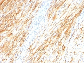 GFAP Antibody / Glial Fibrillary Acidic Protein