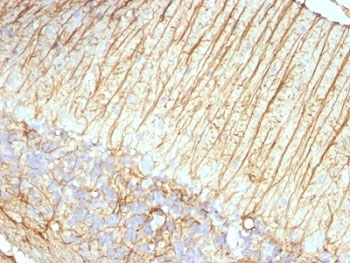 GFAP Antibody / Glial Fibrillary Acidic Protein