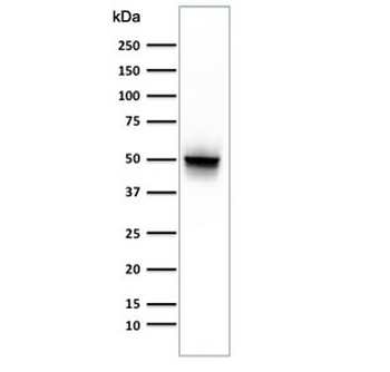 GFAP Antibody / Glial Fibrillary Acidic Protein
