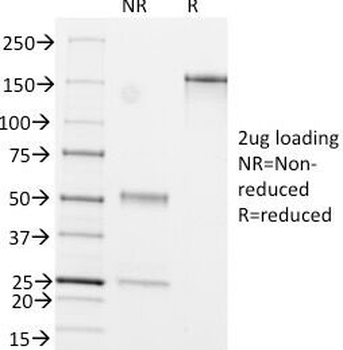 GFAP Antibody / Glial Fibrillary Acidic Protein