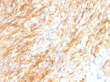 GFAP Antibody / Glial Fibrillary Acidic Protein Cocktail