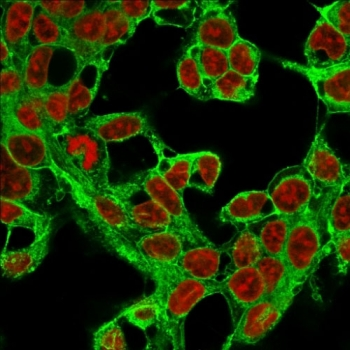 Glypican 3 Antibody / GPC3