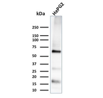 Glypican 3 Antibody / GPC3